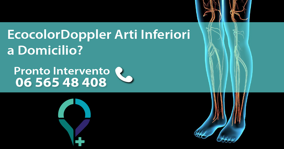 EcoColorDoppler Arti Inferiori | Medical AIM